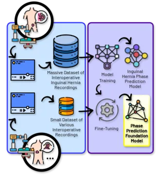 Optimizing Computer Vision in Surgery Workflows Through Transfer Learning